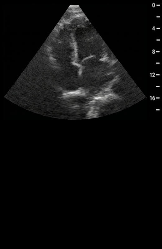 B-Mode Baseline