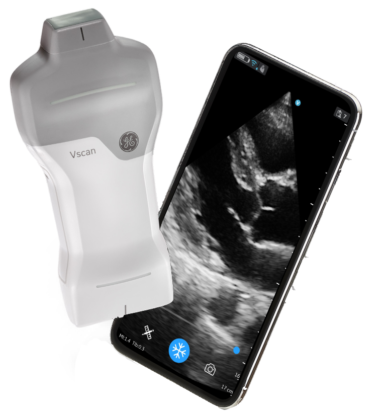 GE VScan Air-SL